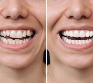 dentist Manchester